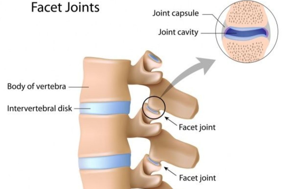 Facet Pain