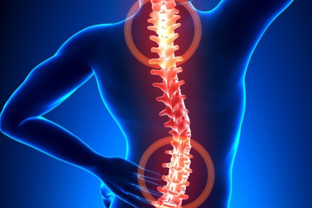 Spinal Stenosis