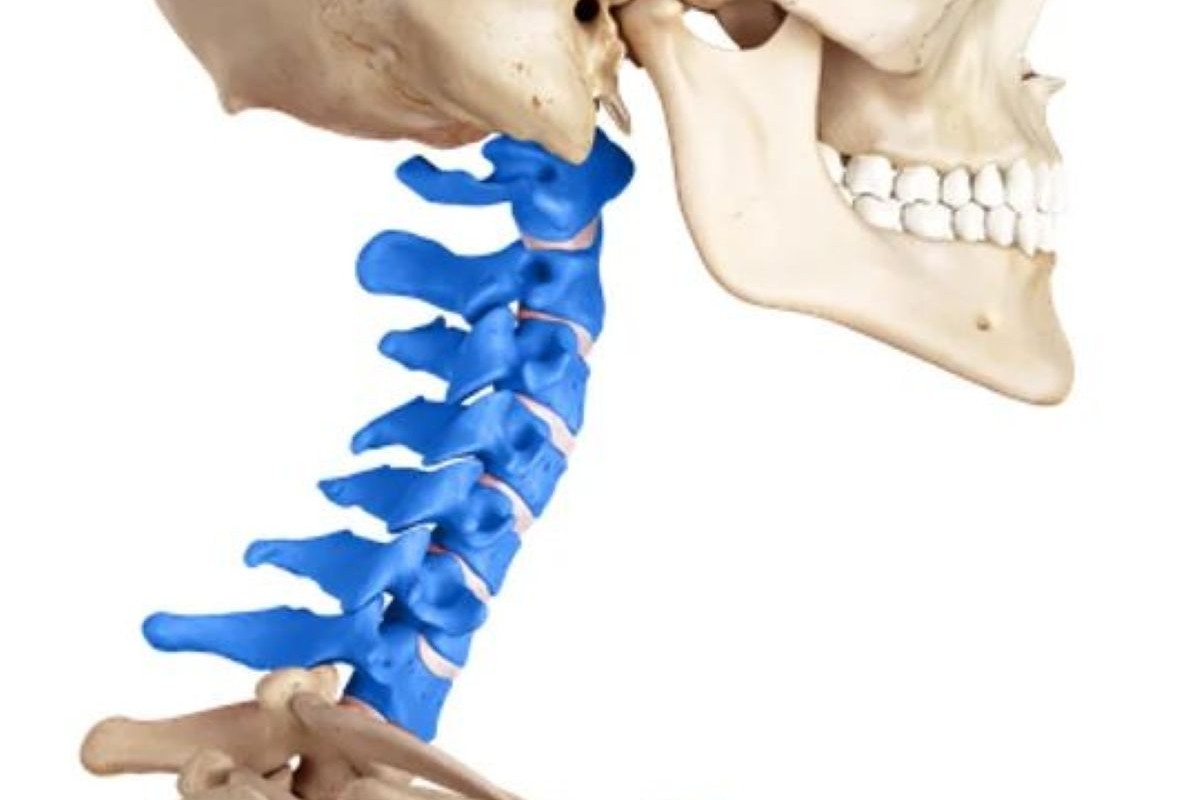 Cranio-vertebral Anomalies