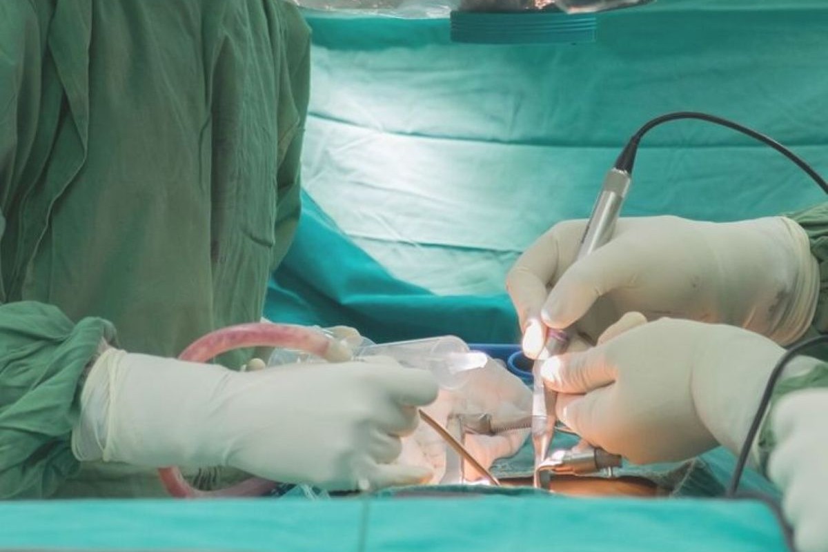 Full Endoscopic Rhizotomy