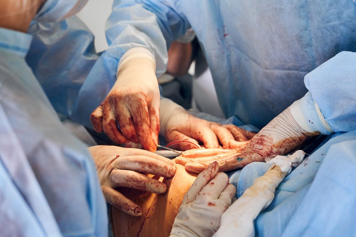 Full Endoscopic spinal fusion