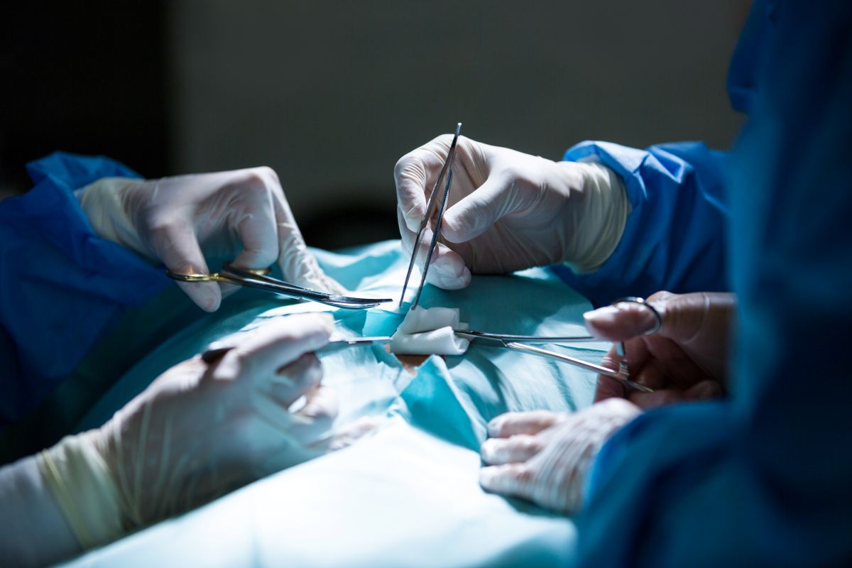 Anterior Cervical Corpectomy